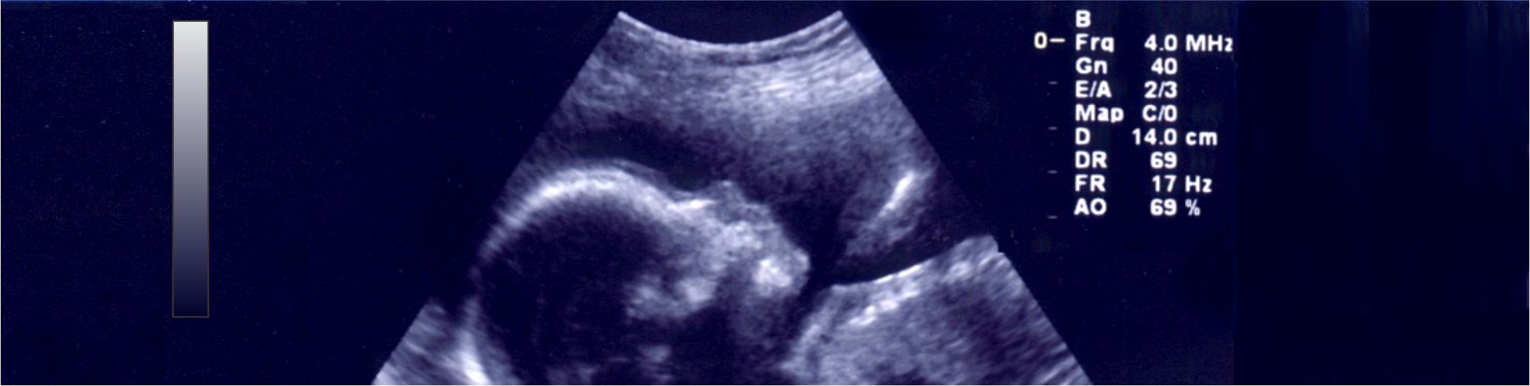imagen de ultrasonido